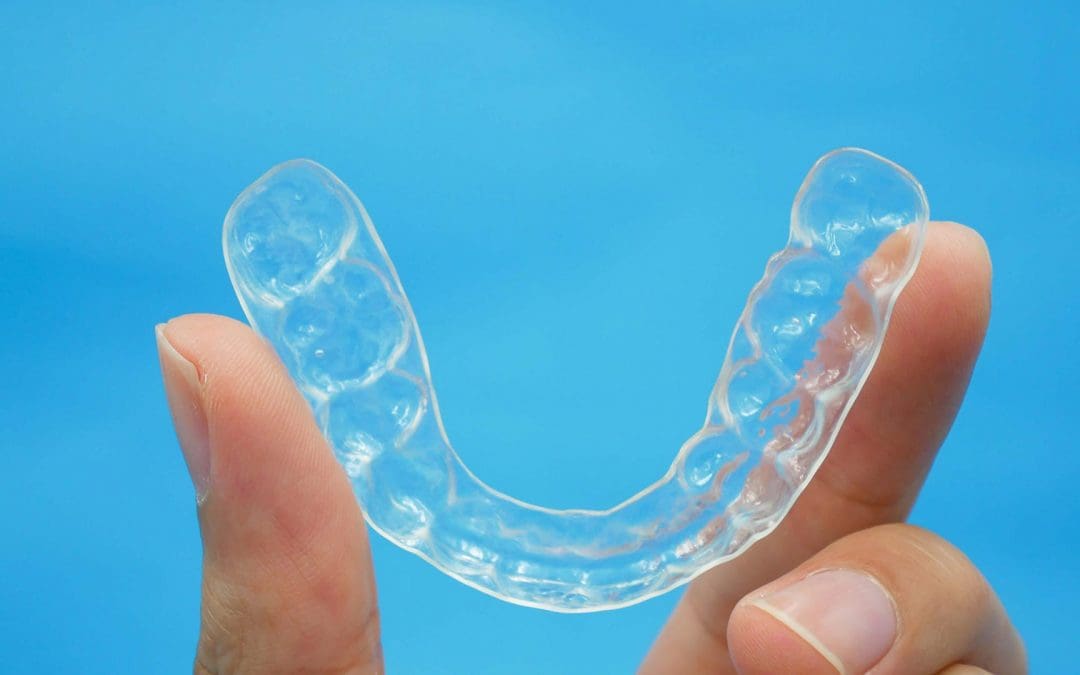Why are at home Aligner companies so much cheaper than Dentists?