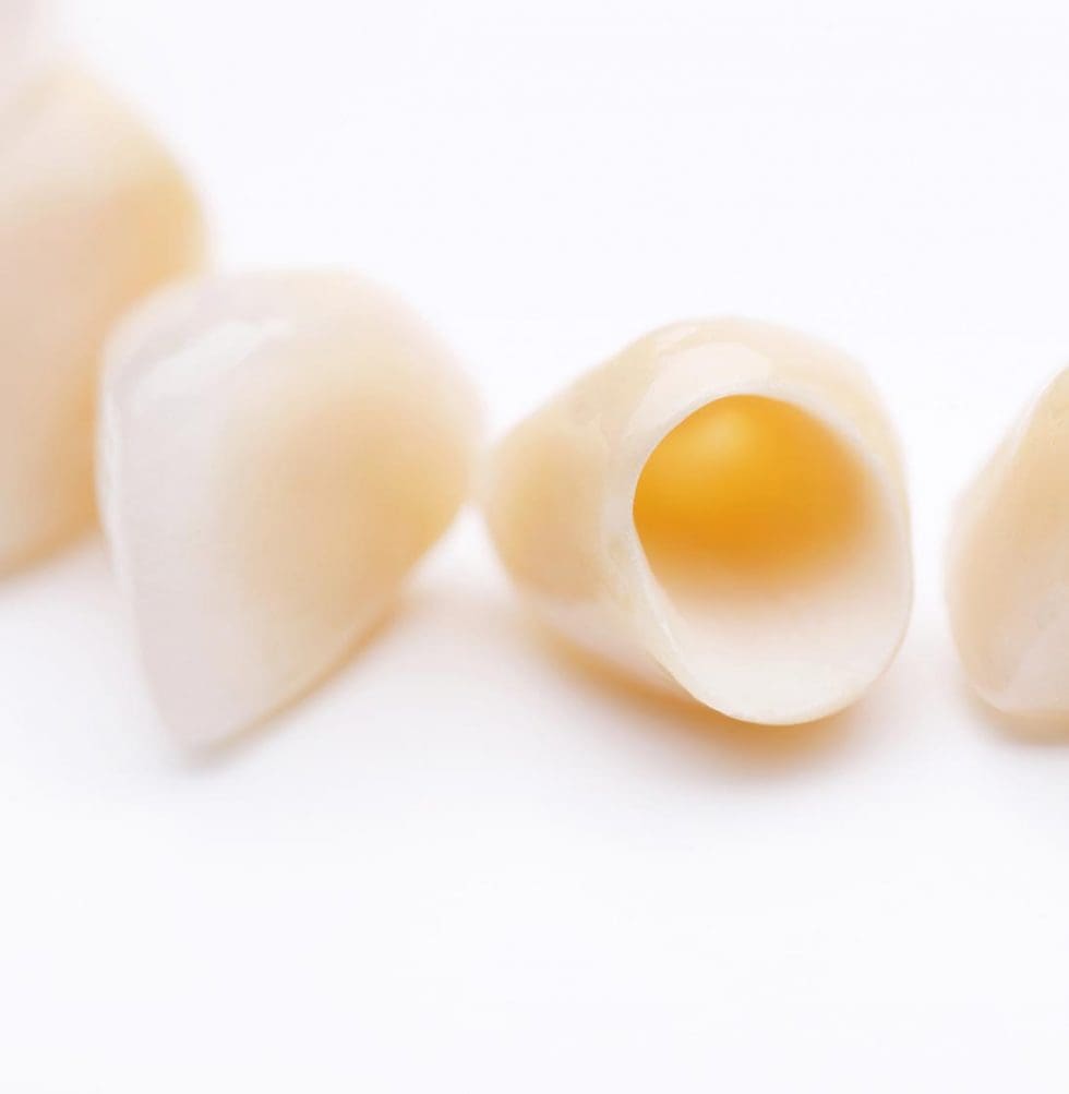 Why do I need my teeth shaved when I get crowns or veneers? The