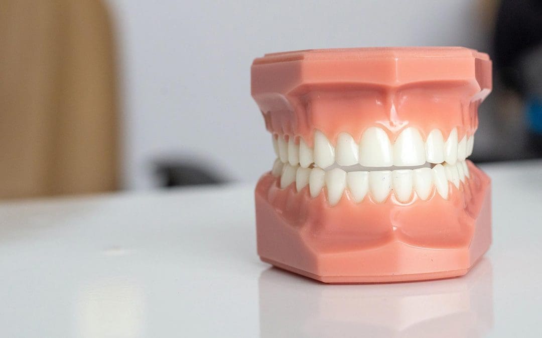 Why are at home Aligner companies so much cheaper than Dentists?