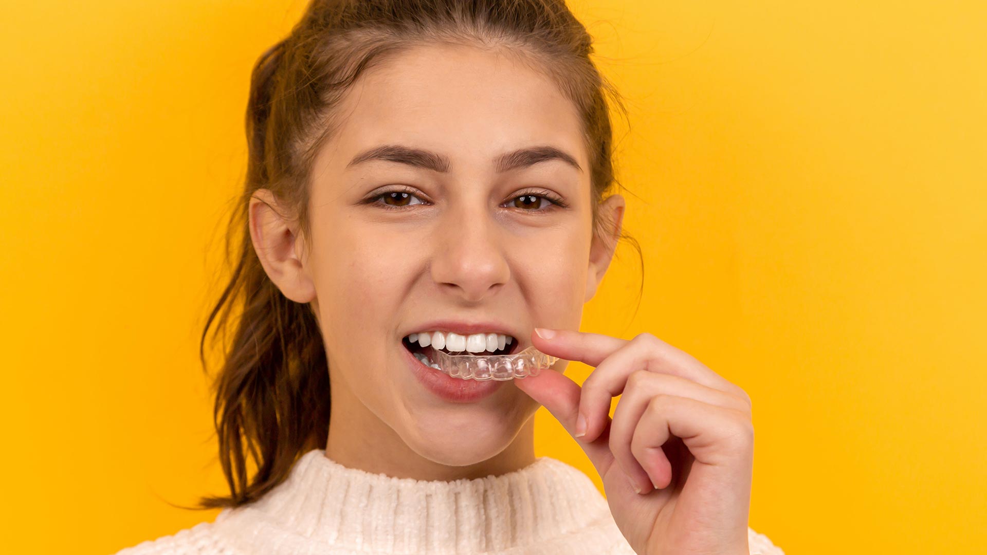 teeth-aligners